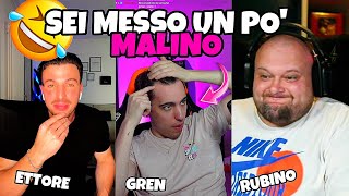 PREVENIRE E CURARE LA CALVIZIE con ETTORE CASOLIN!!🧑‍🦲🎪