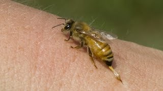Укус пчелы. ПРОВЕРЬТЕ РЕАКЦИЮ Укус пчелы. ПРОВЕРЬТЕ РЕАКЦИЮ