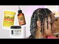 I Tried the Sulfur8, Doo Gro, & Jamaican Black Castor Oil Challenge And...