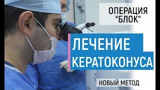 Лечение кератоконуса. Самая эффективная методика БЛОК. Сравнение, преимущества, все об операции.