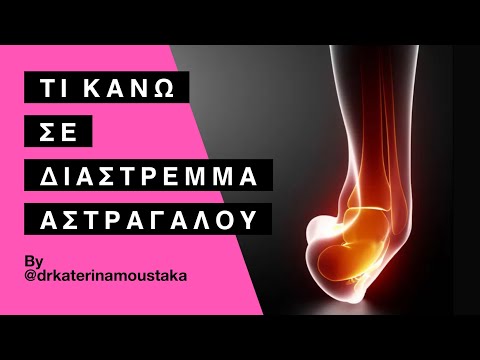 ΤΙ ΚΑΝΩ ΣΕ