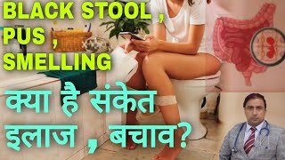 BLACK STOOL , PUS , SMELLING || क्या है संकेत इलाज , बचाव ? || Dr Kumar Education Clinic screenshot 5