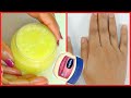 QUICK & EASY DIY HAND MOISTURIZER, GET RID OF DRY HANDS FOR SOFT SMOOTH HANDS