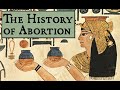 Family Planning in the Ancient World