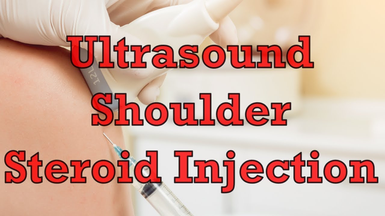 Ultrasound Guided Shoulder Cortisone (Steroid) Injection John Stavrakos, MD Vitality Medical