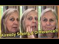 Does This Dark Spot Remover Actually Work? My Real Results