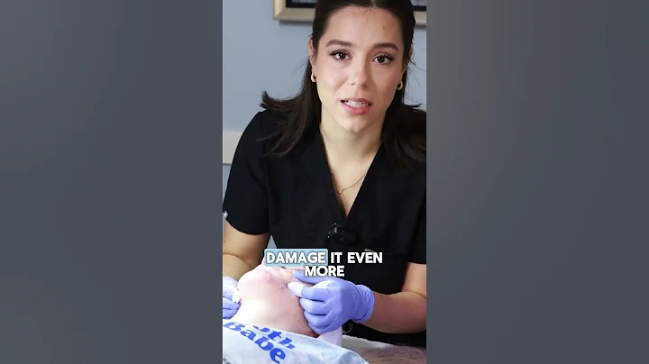 Should you pop pimples???