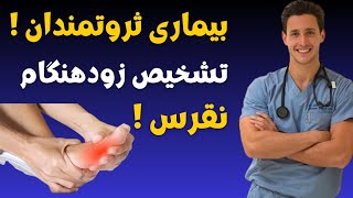 این غذاها برای نقرس مضر است / درمان بیماری نقرس فقط با پرهیز غذایی