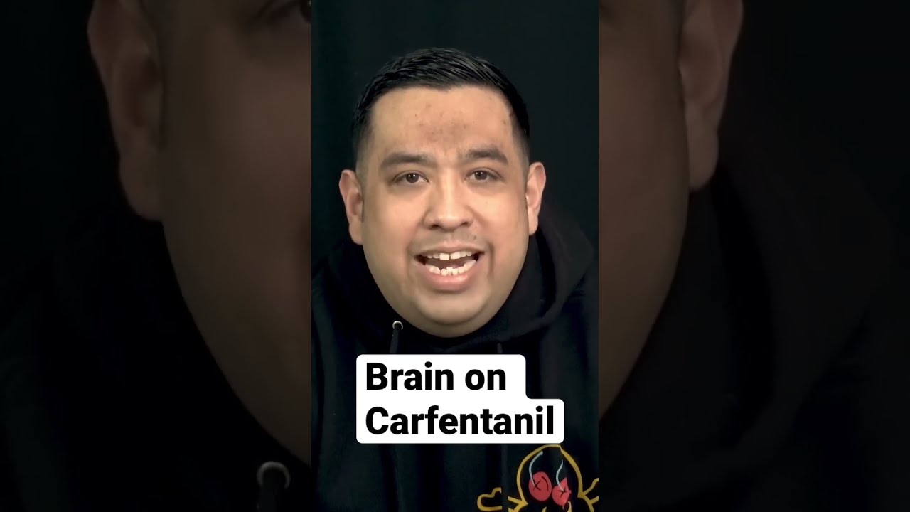 Effects Of Carfentanil On The Brain Addiction Recovery Mentalhealth Addictionrecovery Drugabuse