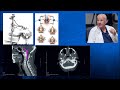 Episode 13 part 1 giants of spine surgery  craniocervical junction surgery  volker sonntag md