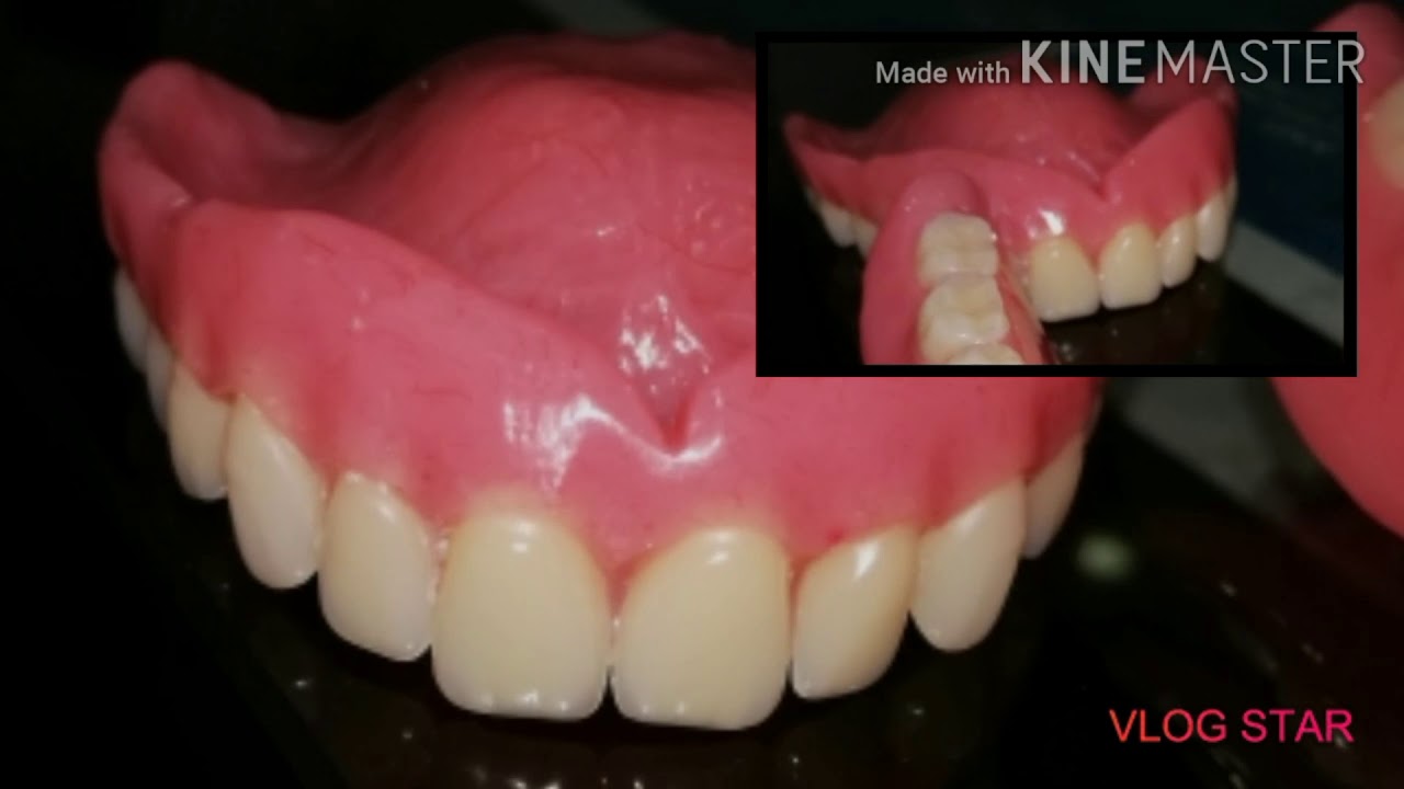 Batisee complete denture multan best dentist in Multan SN DENTAL