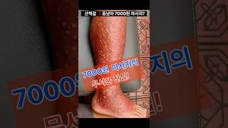 동남아 7000원 마사지의 충격적 진실 | 수술까지 간 실제 사례