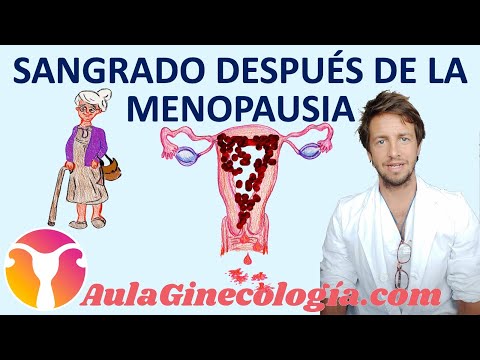 Vídeo: Sangrado Posmenopáusico - Definición Y Educación Del Paciente