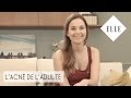 Quelles solutions contre l'acné de l'adulte ?┃ELLE Skincare