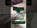 The BIGGEST Aural Abscess In a Turtle