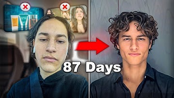 How To Develop Your Bone Structure (Full Guide)