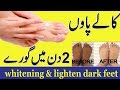 How to whitening  lighten dark feet in 2 days  anam home remedy