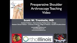 Preoperative Shoulder Arthroscopy