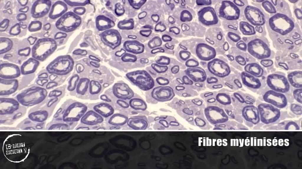 "C'est quoi une maladie auto-immune ?", avec Jenny Valladeau