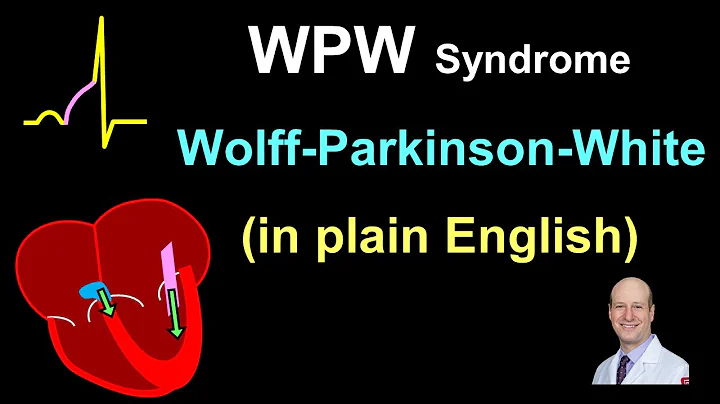 WPW: Explanation and Treatment - in Plain English!