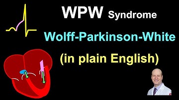 WPW: Explanation and Treatment - in Plain English!