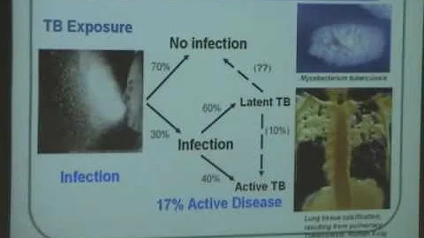 ICP - 2/5 Carol Nacy; MAP & Crohn's