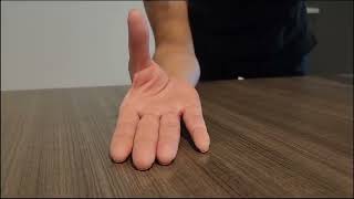 Pronation Compensation Sign as a Diagnostic Tool for Carpal Tunnel Syndrome - Video S1 [455117]