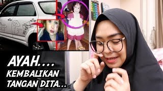 MERINDING. KISAH DITA, ANAK KECIL YANG KEHILANGAN KEDUA TANGANNYA.