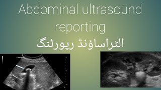 Ultrasound showing report detailsSonography123 ultrasonographyyoutubeusaindia123 radiologyusa