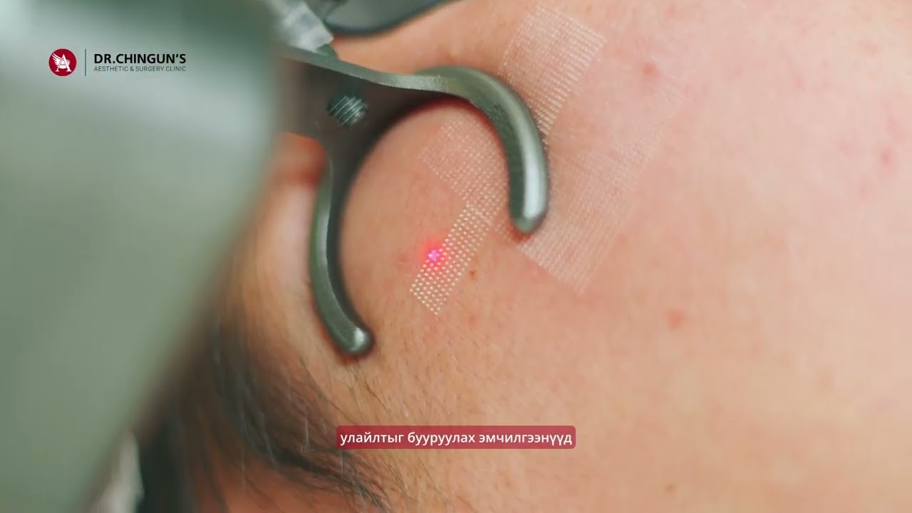 ЭМЧ ТАЙЛБАРЛАХ НЬ: 15. БАТГА, БАТГАНЫ СОРВИ ЭМЧИЛГЭЭ