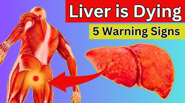 Top 5 Early Symptoms of Hepatitis B and C You Need to Know