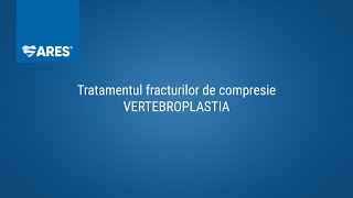 Vertebroplastia | Fracturi de compresie| Tratament | ARES