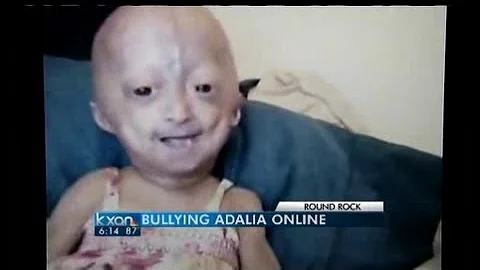 Cyber bullying of child with rare disease