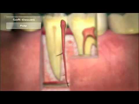 ვიდეო: როდესაც ლეკვები იცვლიან კბილებს