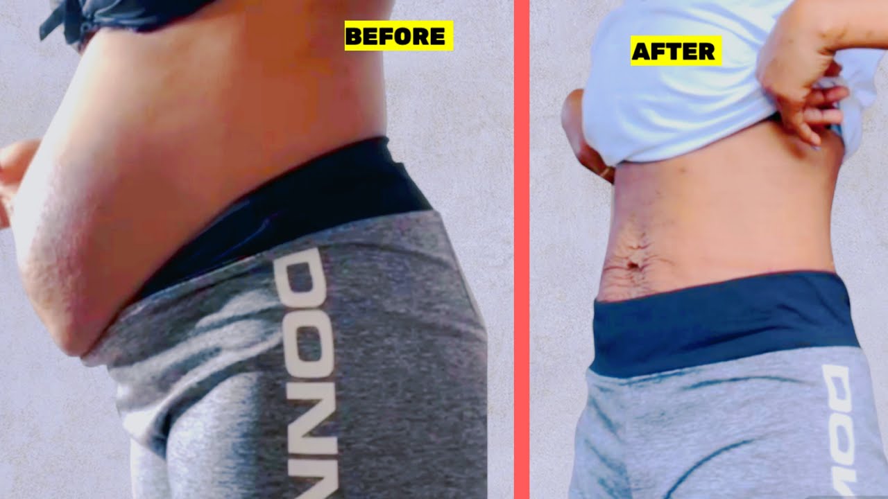 EXERCISE FOR HANGING BELLY FAT AND WEIGHT LOSS 🔥FLAT STOMACH BURN