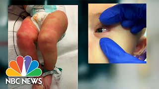 Alarming Rise in Child Illness Linked To Covid-19, Protests Continue Across the U.S | Nightly News