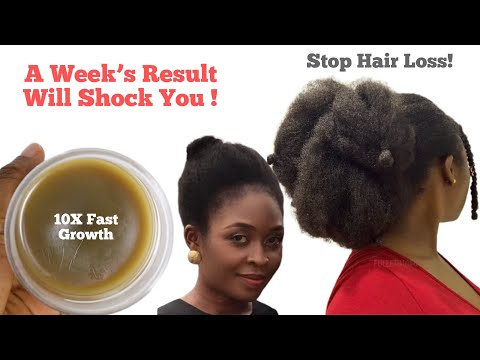 ONLY 2 POWERFUL INGREDIENTS FOR FAST HAIR GROWTH;Grow Thicker Longer Hair