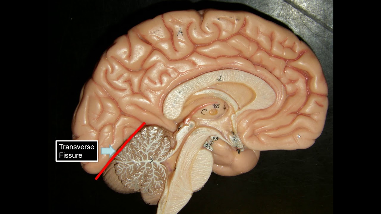 SEXTON BIOL 2401 LAB BRAIN - YouTube