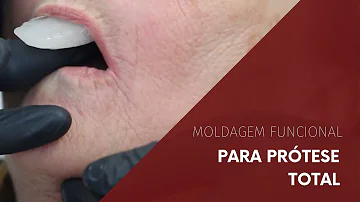 Quais os materiais de moldagem utilizados na moldagem funcional?