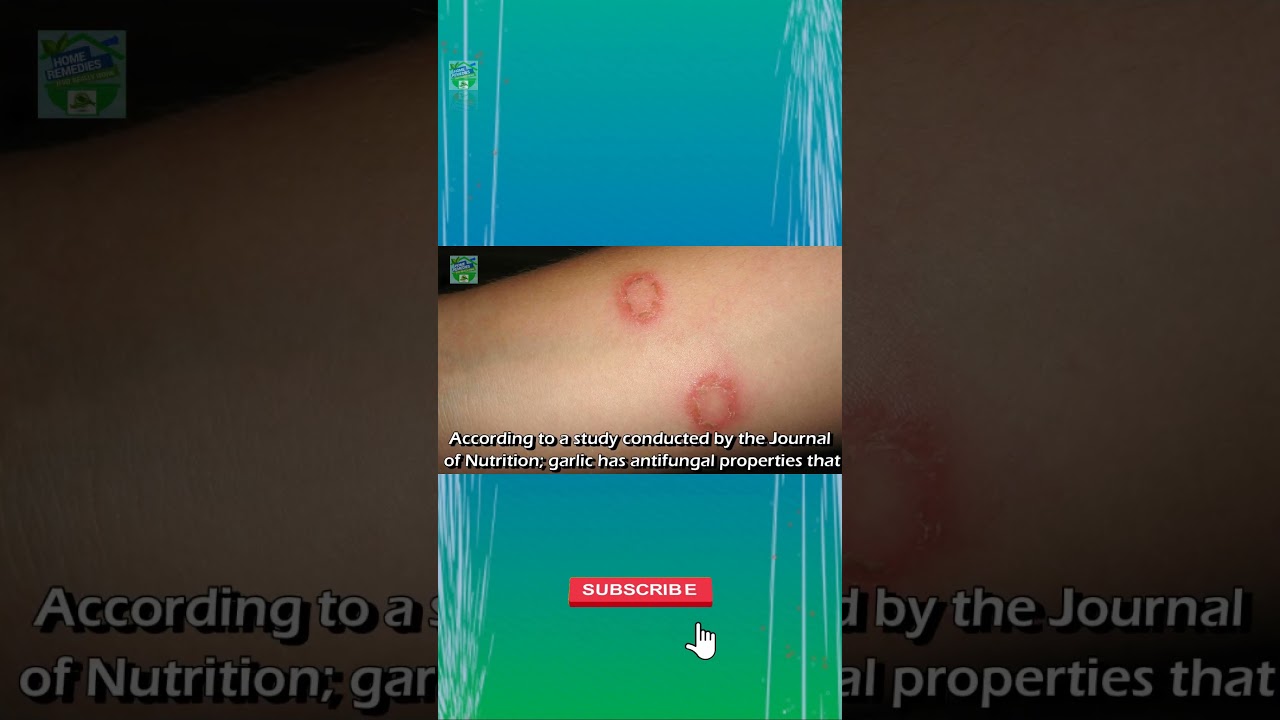 Чесночное масло БОРЕТСЯ с проблемами кожи? 🧄 