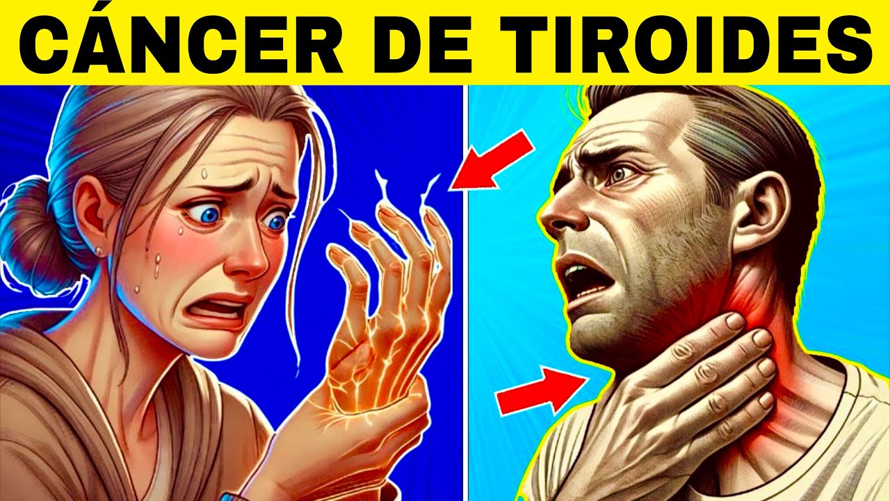 8 Signos Extraños de CÁNCER DE TIROIDES (Síntomas de Cáncer de Tiroides)