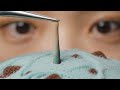 【NG】スッキリしない?🤨ゼリー抜き🪡