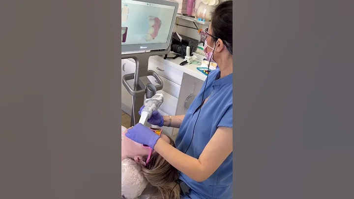 Veneer replacements #veneers #dentist #cosmeticdentist