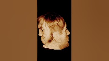 man with an extra face at the back of his head #enigmatic #shorts #history #rare #facts