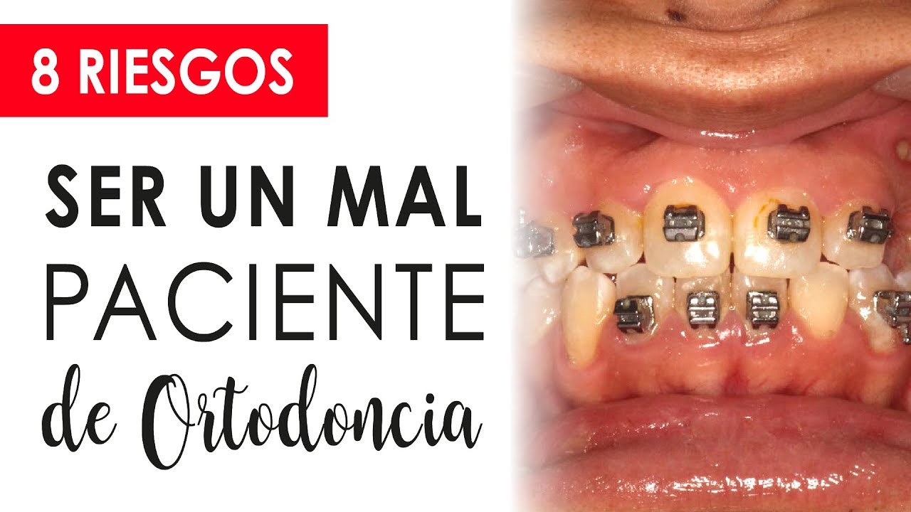 8 RIESGOS DE SER UN MAL PACIENTE DE ORTODONCIA | ¡CUIDADO! 😱