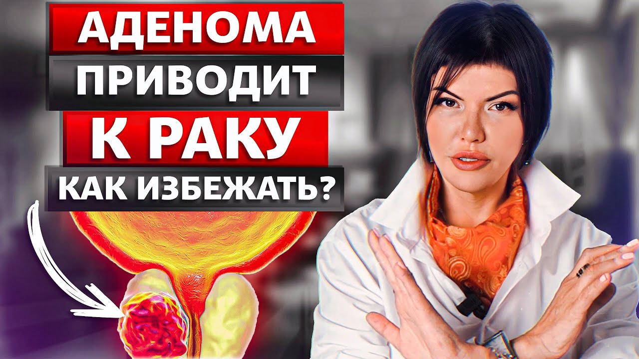 Аденома простаты. Лечение БЕЗ операции ВОЗМОЖНО! Уролог Воронеж