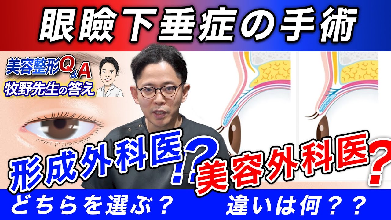 【Q&A眼瞼下垂症手術】形成外科医と美容外科医の手術の違いは？？
