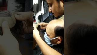 hair patch for men | call now:- 9064172241 hairpatch hairloss hairstyle shouts anirudh