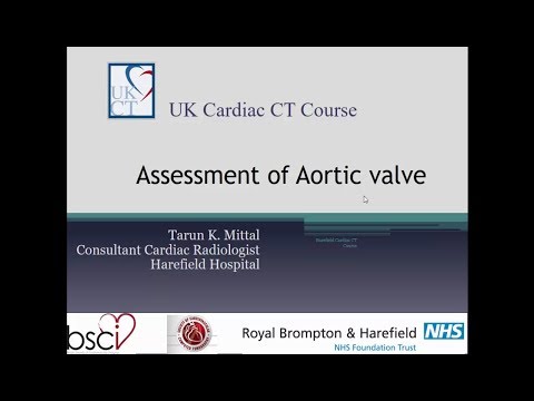 CT in Aortic Valve and TAVI