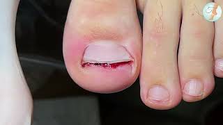 Trupicou e olha no que deu #nails #satisfying 